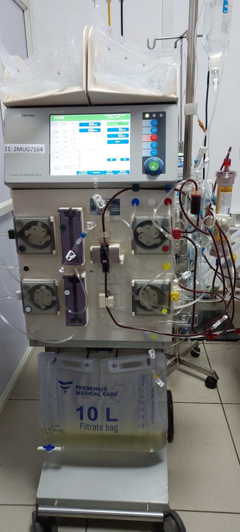 New Hdf Machine Nephrology - VIMS-College