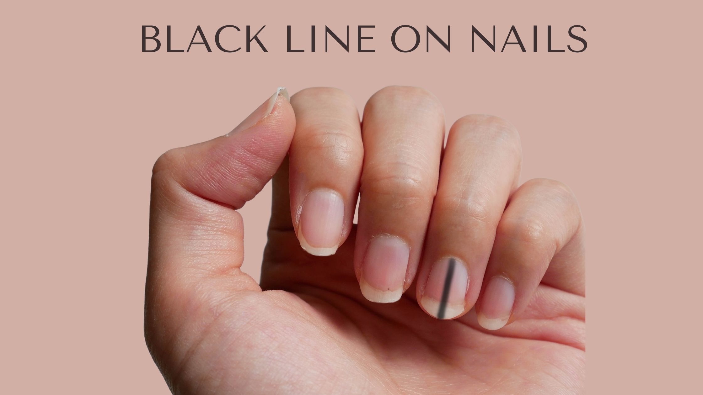 Black line on nails