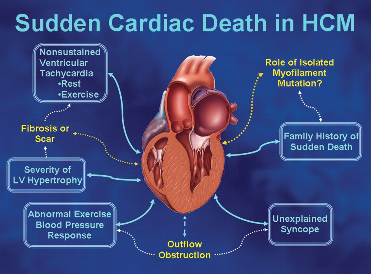 hypertrophy of the heart