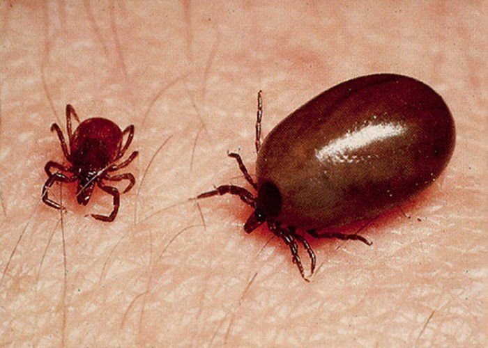 Scrub Typhus