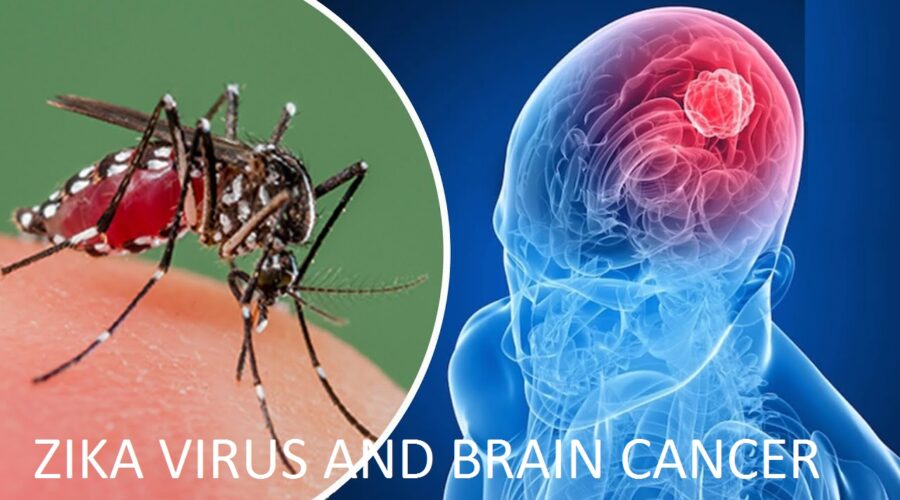 Zika Virus and Brain Cancer
