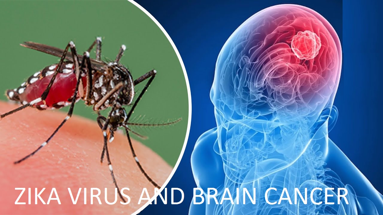 Zika Virus and Brain Cancer