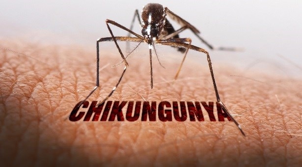 Chikungunya in India