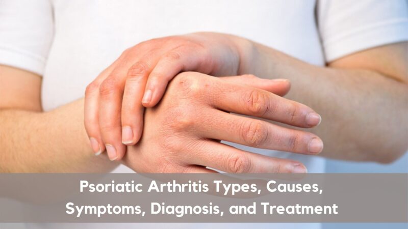 Everything You Need To Know About Psoriatic Arthritis - VIMS