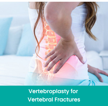 Vertebroplasty for vertebral fractures