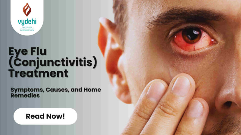 eye-flu-treatment-children-may-get-fever-due-to-conjunctivitis-keep