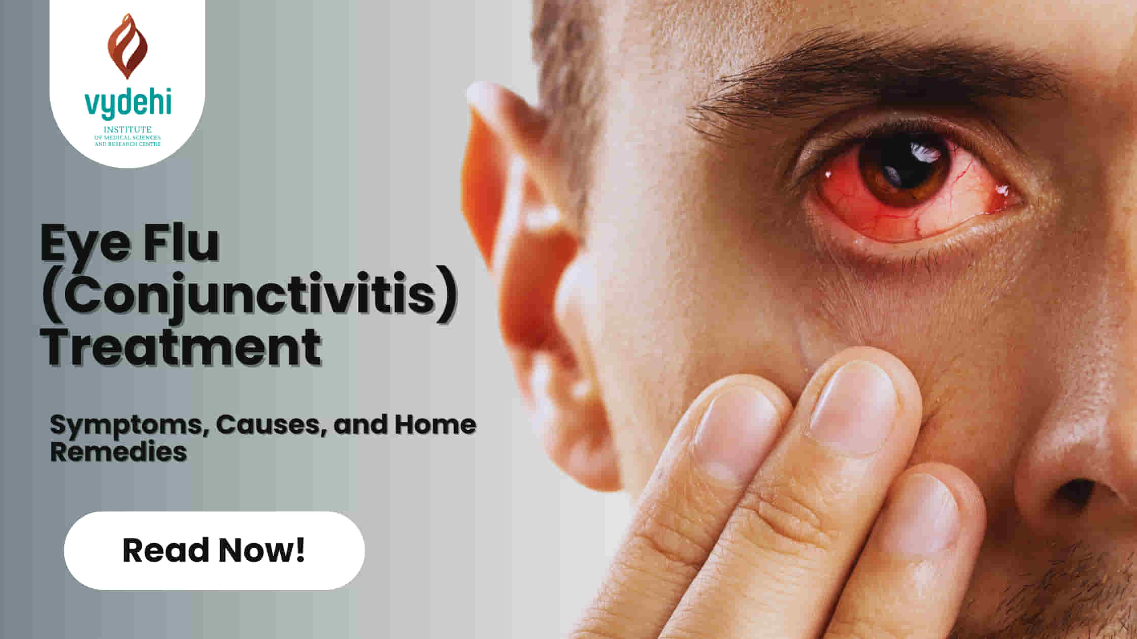 Eye Infection: Symptoms, Causes & Treatment