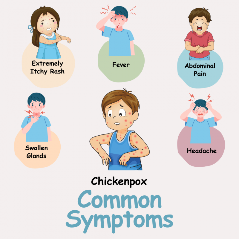 Myths: Separating Fact from Fiction About Chicken Pox | VIMS&RC