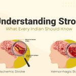 Understand Stroke: Know the Signs, Save Lives