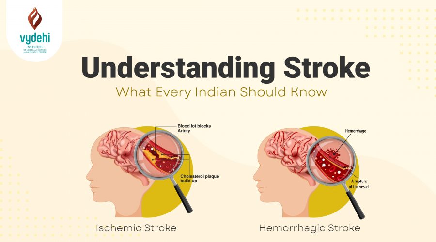 Understand Stroke: Know the Signs, Save Lives