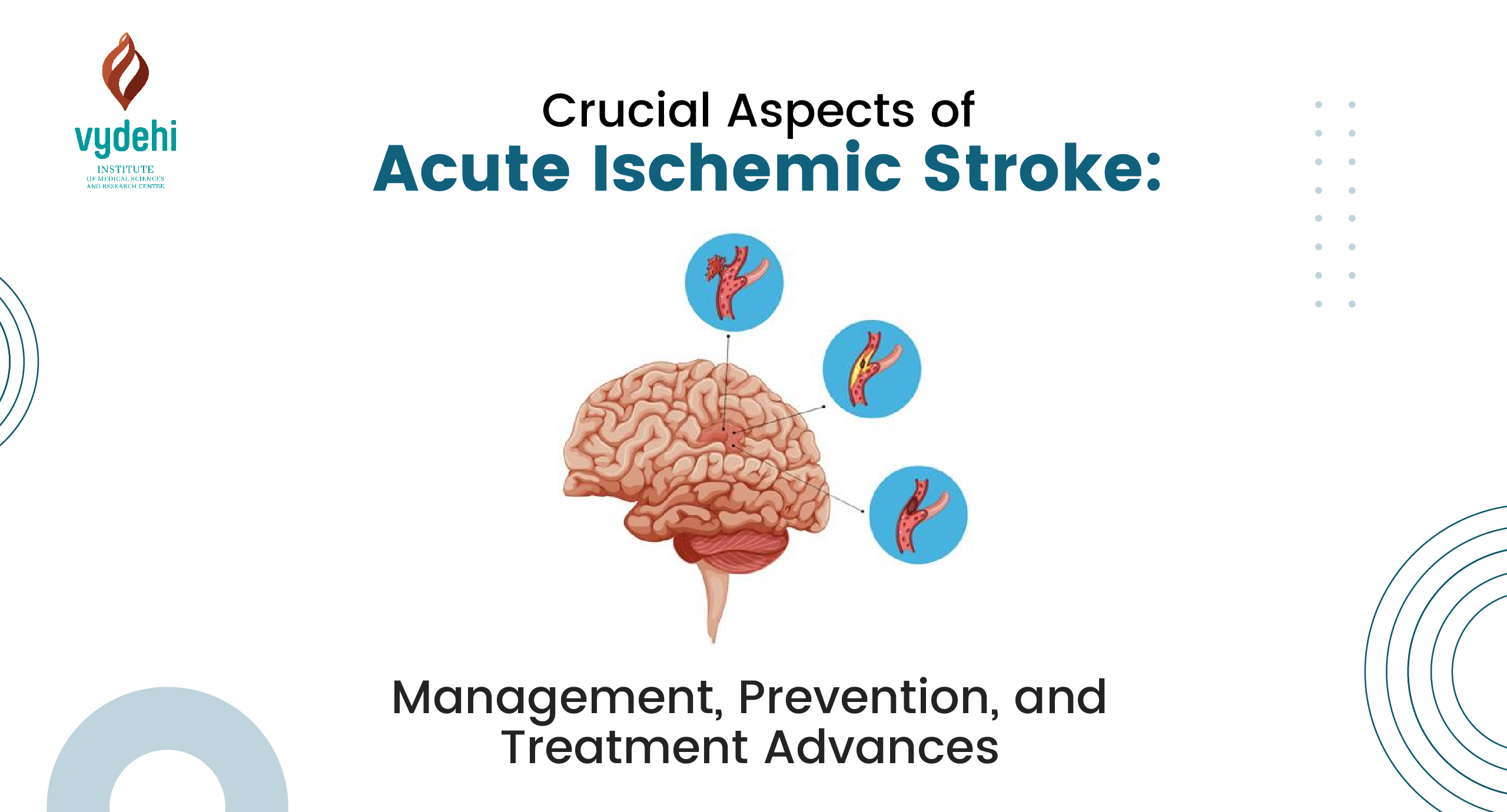 Acute Ischemic Stroke