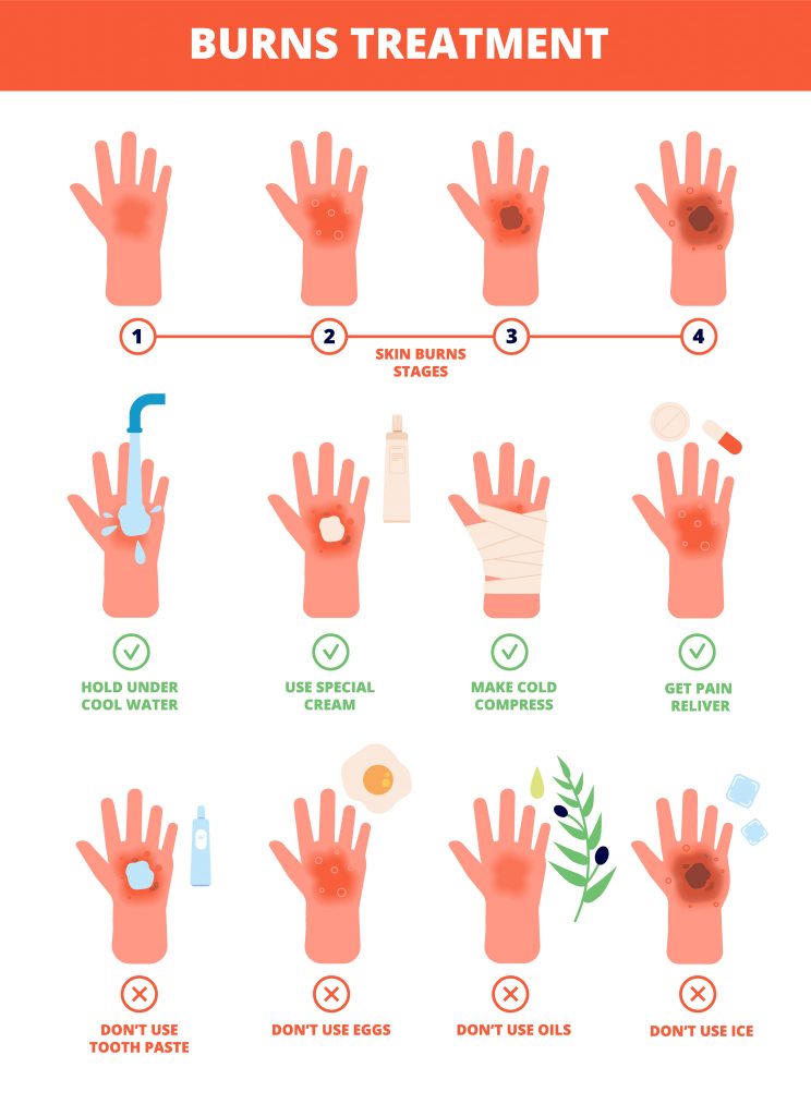 Burn treatment