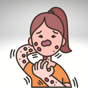 Allergic reactions