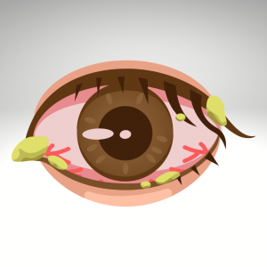 Eye Diseases in Children