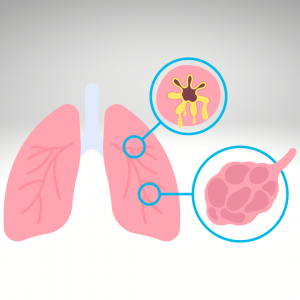 Non-Infectious Diseases in Children
