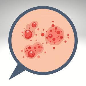 Skin infections