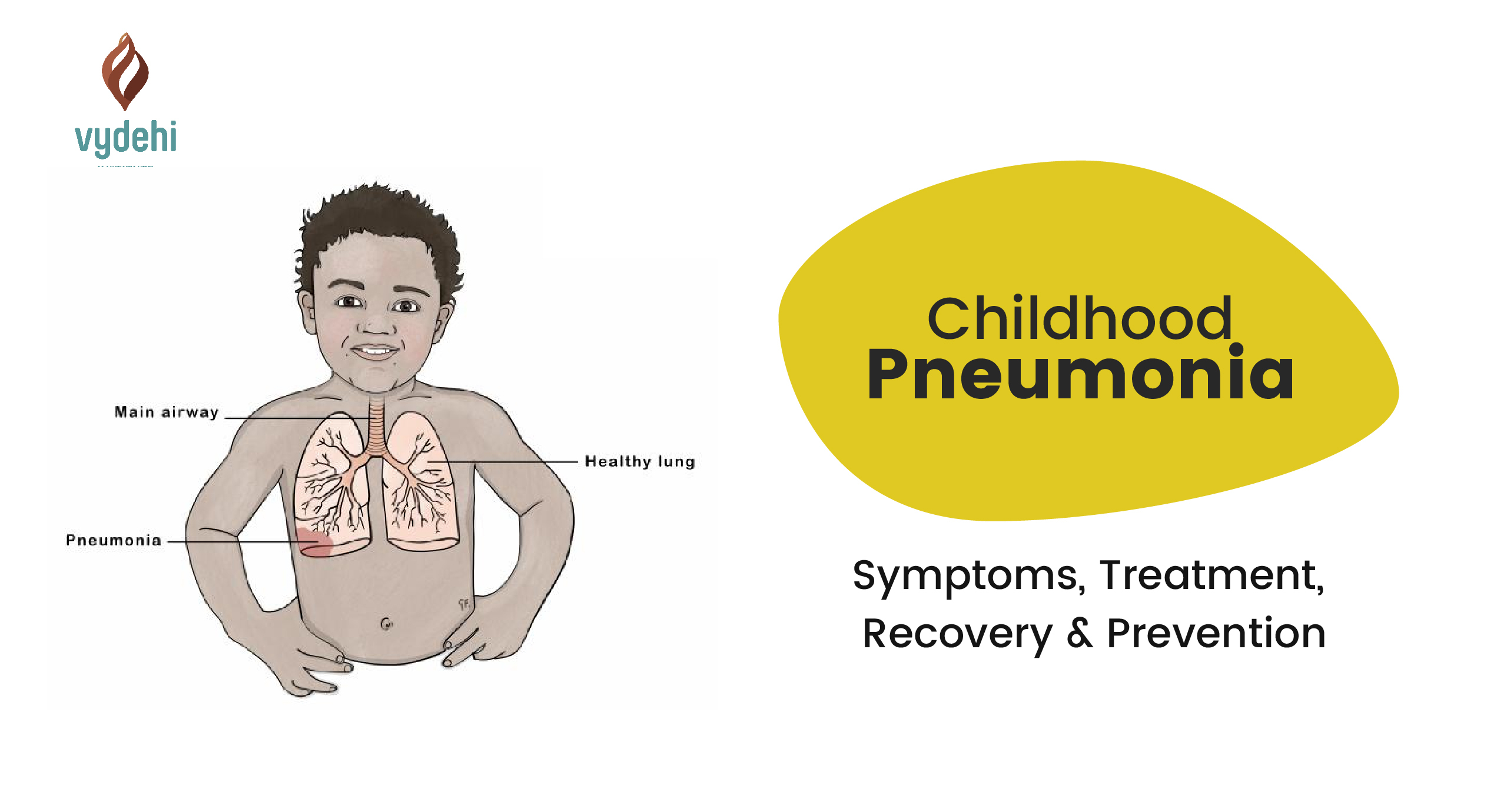 Childhood Pneumonia