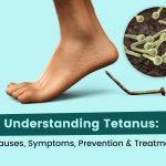 Tetanus