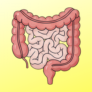 Colon Cancer